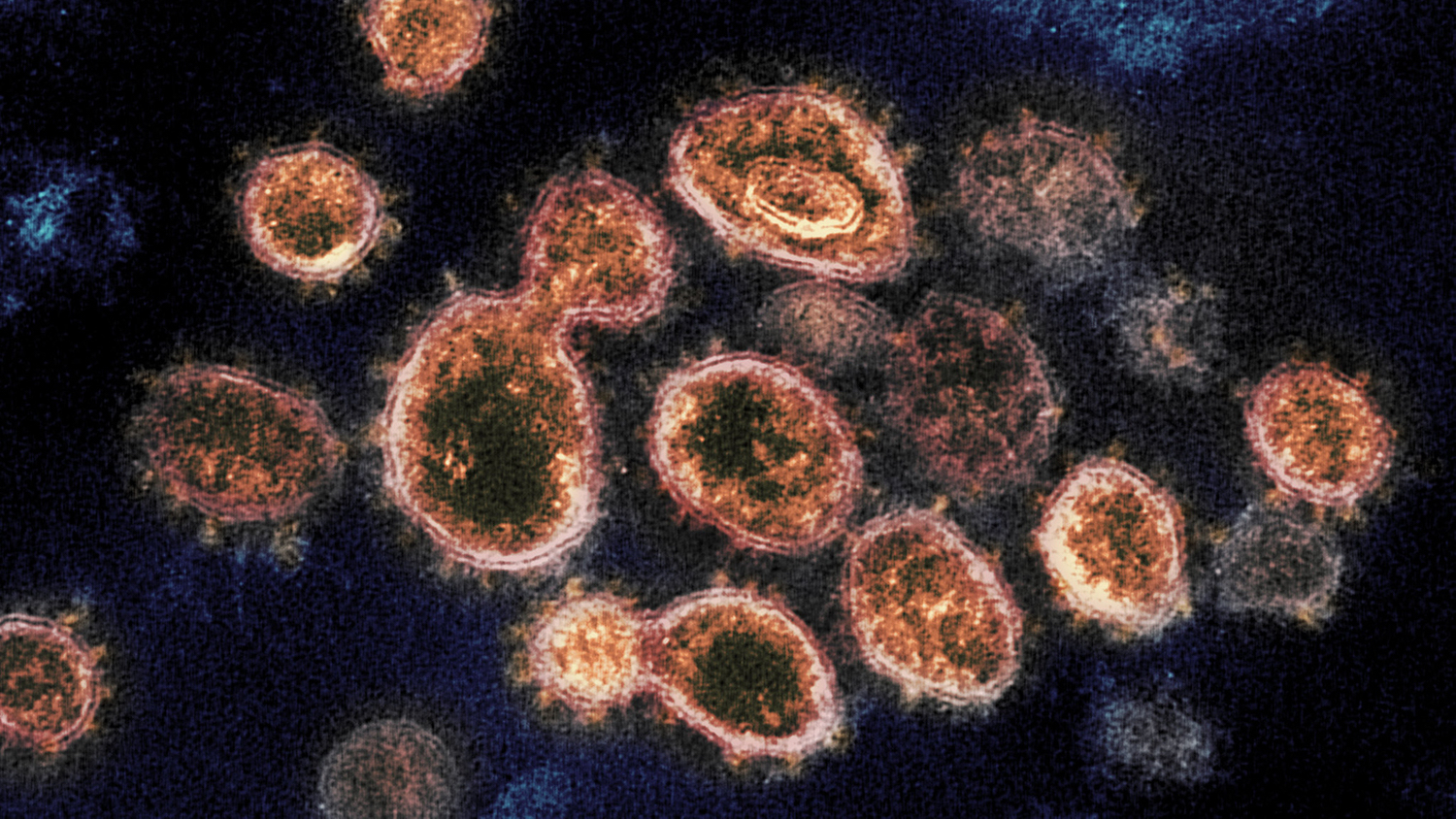 Electron microscope image of the SARS-CoV-2 virus.